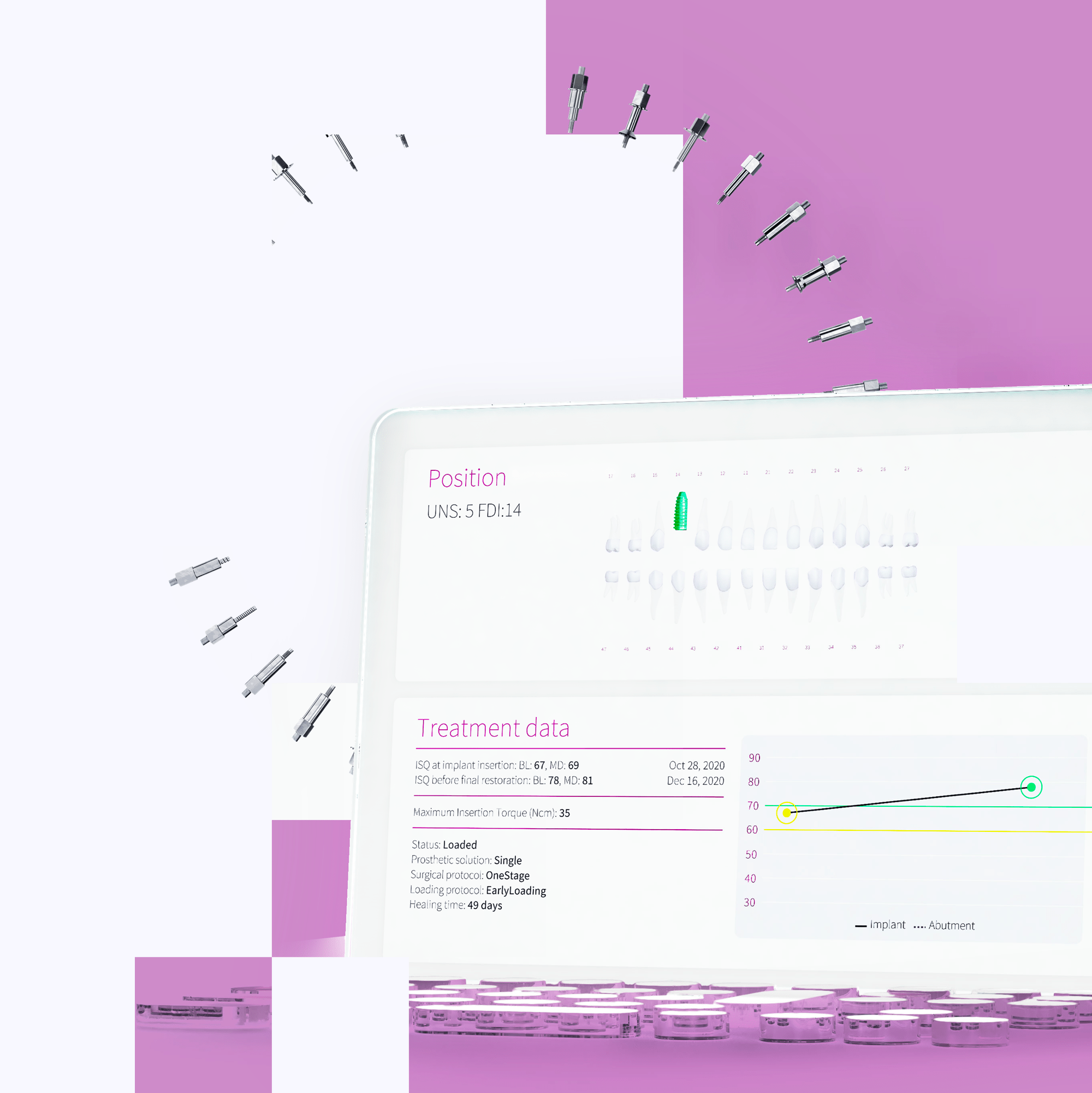 iPad-liknande prototyp som visar Osstell Connect